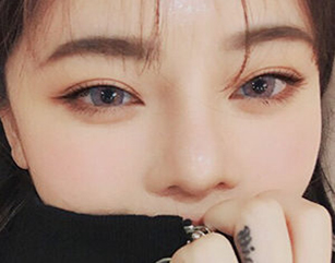Double-Eyelid-Surgery-1