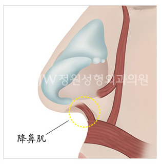韩国箭头鼻长鼻矫正最好的整形医院JW整形医院