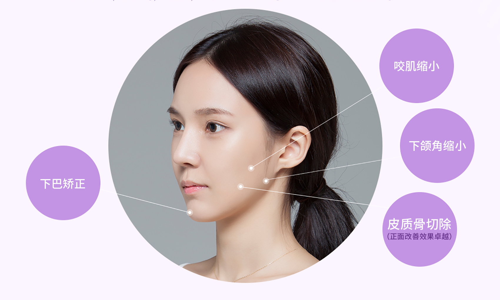 小V脸手术- 韩国JW整形医院