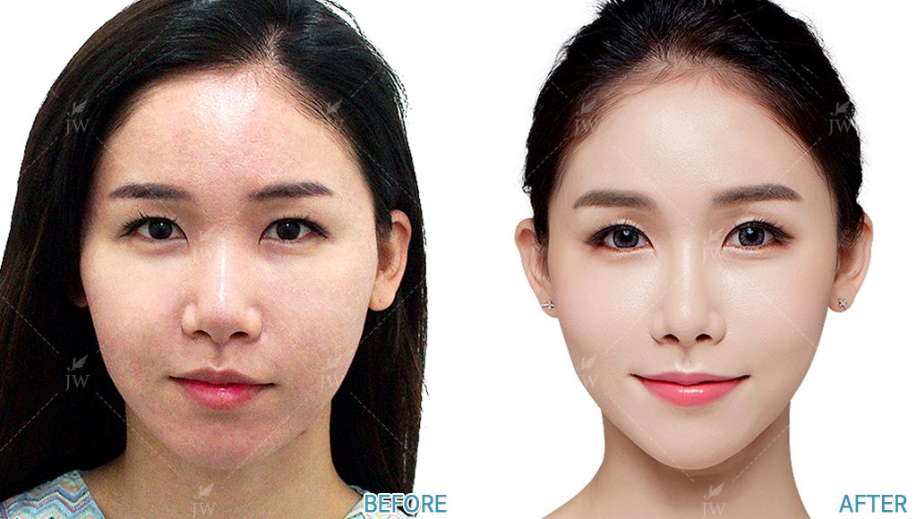 健康・医学 facial bone contouring surgery Current Practices for Esthetic Facial Bone Contouring